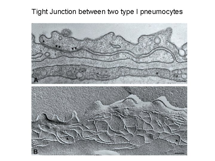 Tight Junction between two type I pneumocytes 