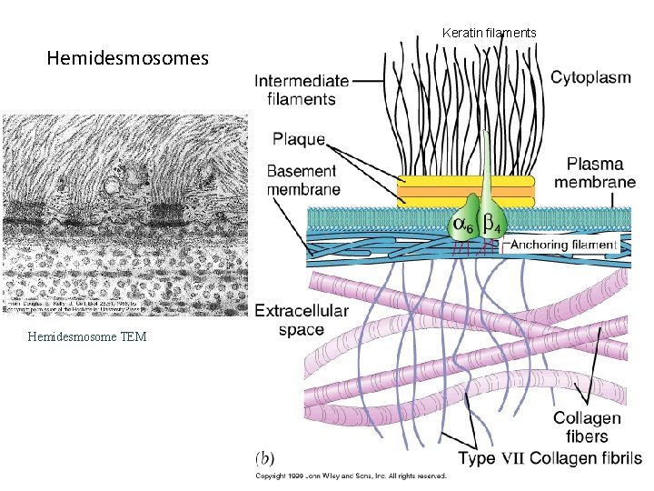 Keratin filaments Hemidesmosome TEM 