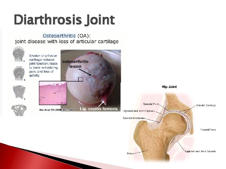 Diarthrosis Joint 