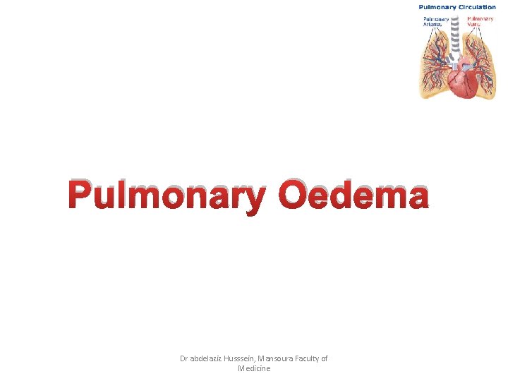 Pulmonary Oedema Dr abdelaziz Husssein, Mansoura Faculty of Medicine 