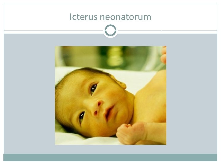 Icterus neonatorum 