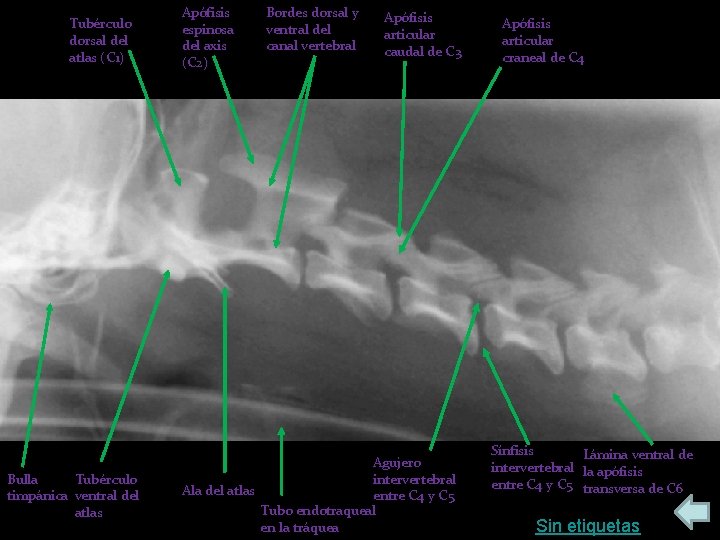 Tubérculo dorsal del atlas (C 1) Bulla Tubérculo timpánica ventral del atlas Apófisis espinosa