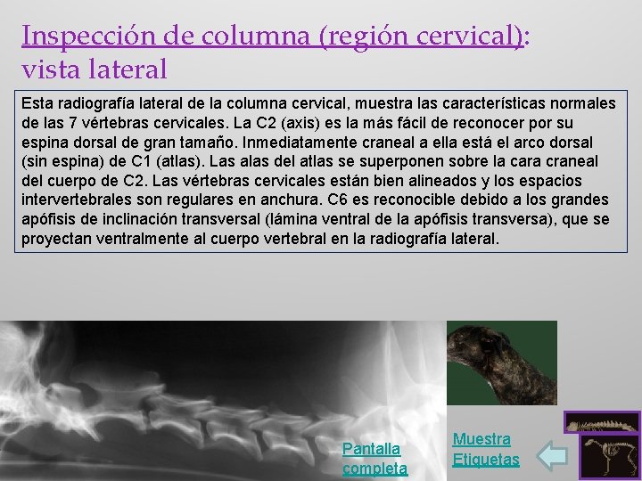 Inspección de columna (región cervical): vista lateral Esta radiografía lateral de la columna cervical,