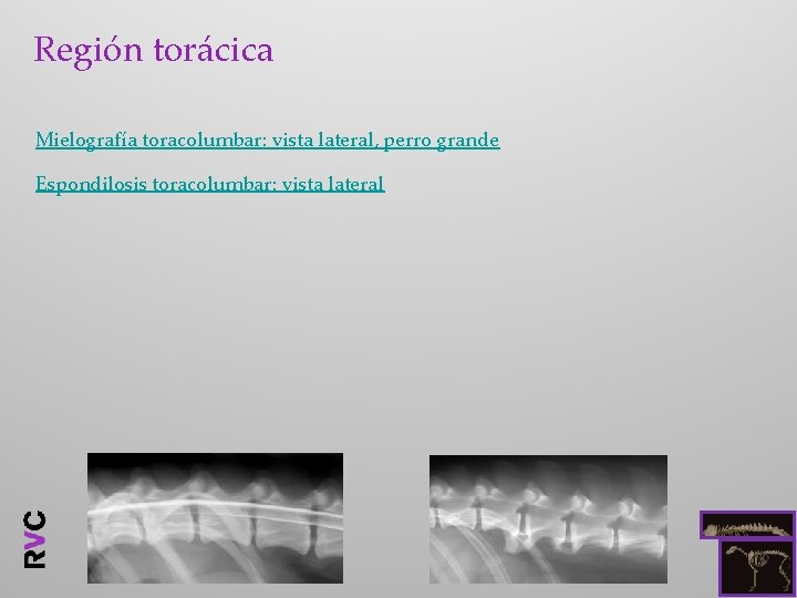 Región torácica Mielografía toracolumbar: vista lateral, perro grande Espondilosis toracolumbar: vista lateral 