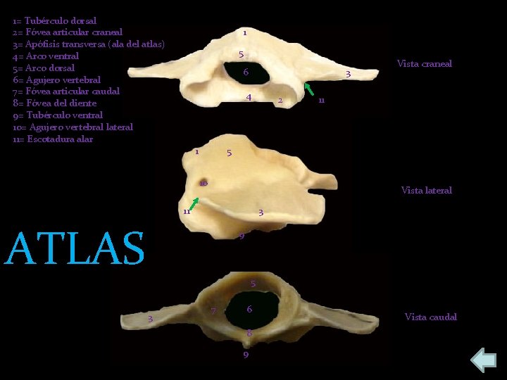 1= Tubérculo dorsal 2= Fóvea articular craneal 3= Apófisis transversa (ala del atlas) 4=