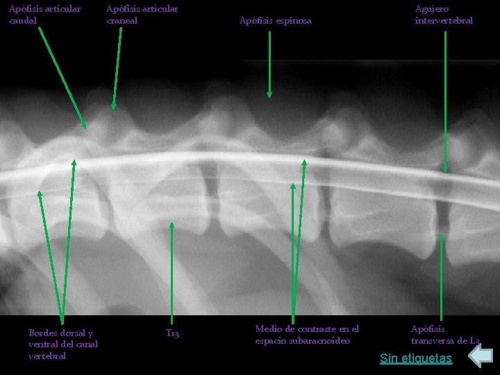 Apófisis articular caudal Bordes dorsal y ventral del canal vertebral Apófisis articular craneal T