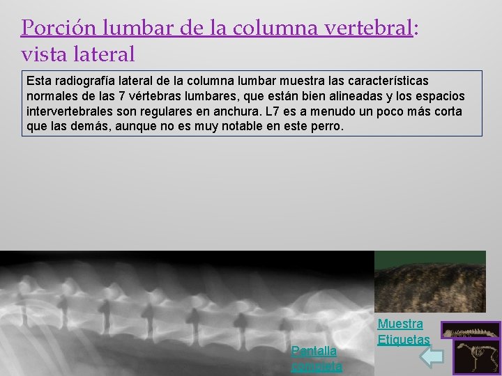 Porción lumbar de la columna vertebral: vista lateral Esta radiografía lateral de la columna