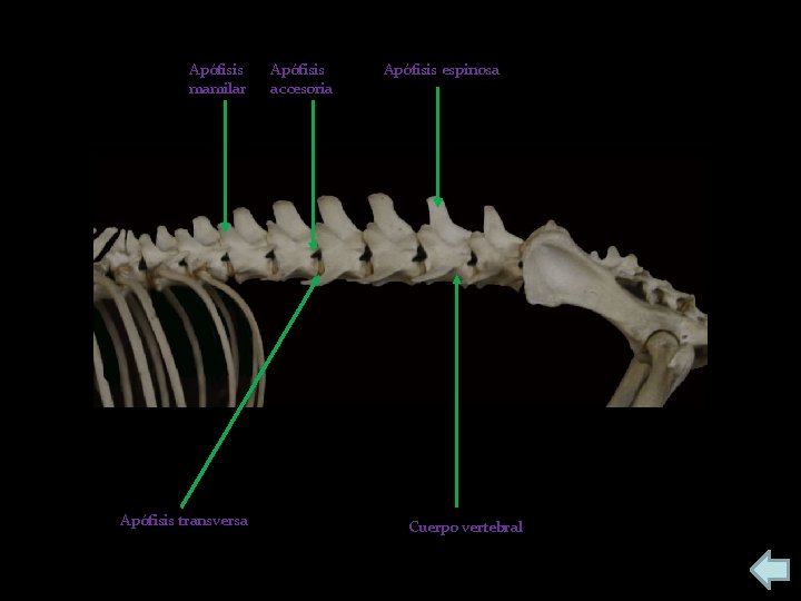 Apófisis mamilar Apófisis transversa Apófisis accesoria Apófisis espinosa Cuerpo vertebral 