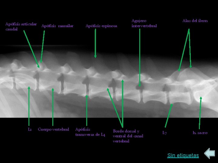 Apófisis articular caudal L 1 Apófisis mamilar Cuerpo vertebral Apófisis espinosa Apófisis transversa de