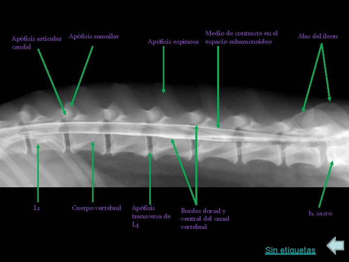 Apófisis articular caudal L 1 Apófisis mamilar Cuerpo vertebral Apófisis espinosa Apófisis transversa de