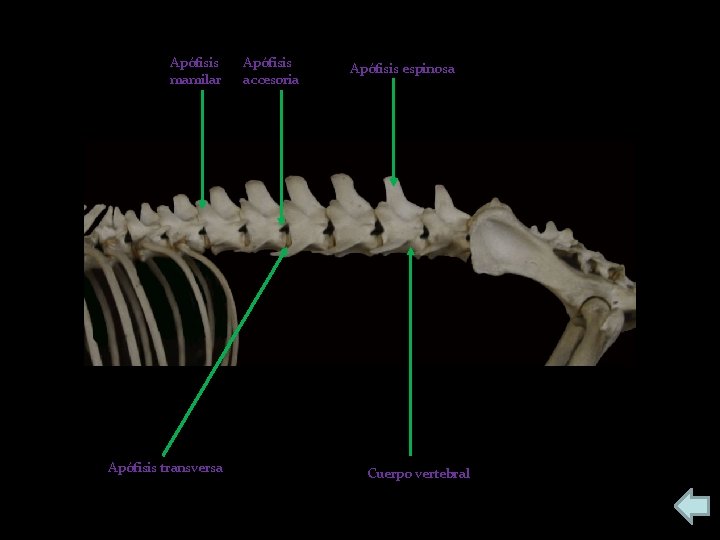 Apófisis mamilar Apófisis transversa Apófisis accesoria Apófisis espinosa Cuerpo vertebral 