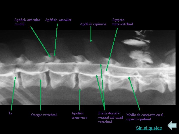 Apófisis articular caudal L 1 Apófisis mamilar Cuerpo vertebral Apófisis espinosa Apófisis transversa Agujero