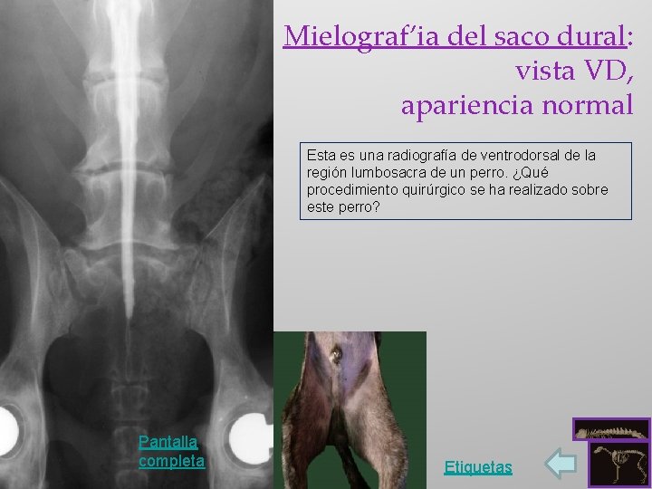 Mielograf’ia del saco dural: vista VD, apariencia normal Esta es una radiografía de ventrodorsal