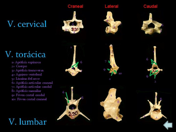 Craneal Lateral 1 V. cervical 4 3 1 1 2 2 7 3 6