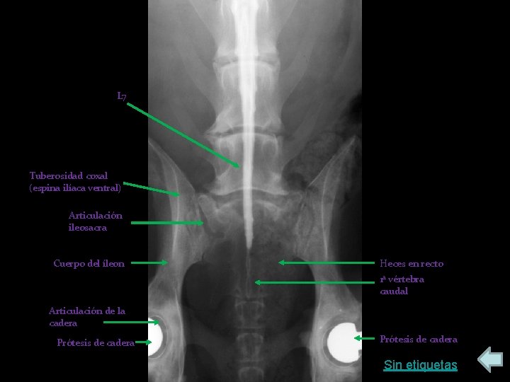 L 7 Tuberosidad coxal (espina ilíaca ventral) Articulación ileosacra Cuerpo del íleon Heces en