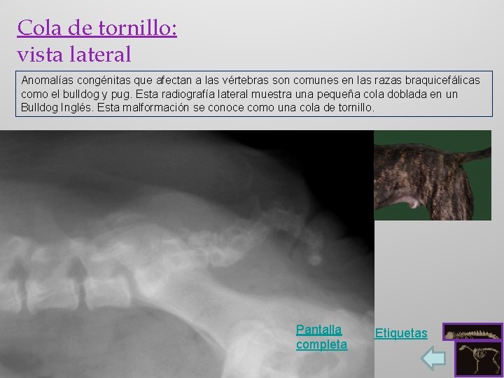 Cola de tornillo: vista lateral Anomalías congénitas que afectan a las vértebras son comunes