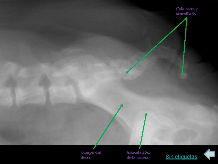 Cola corta y atornillada Cuerpo del íleon Articulación de la cadera Sin etiquetas 