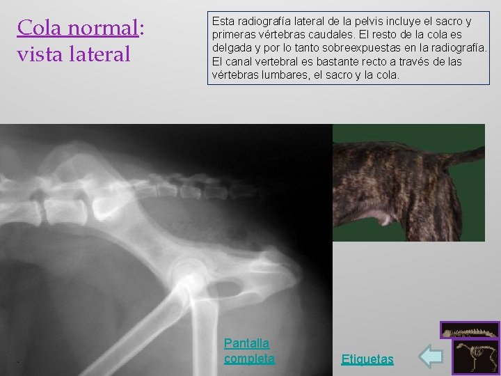 Cola normal: vista lateral Esta radiografía lateral de la pelvis incluye el sacro y