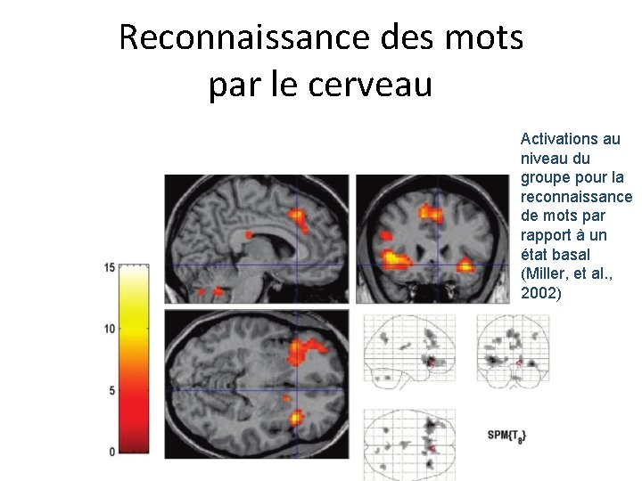 Reconnaissance des mots par le cerveau Activations au niveau du groupe pour la reconnaissance