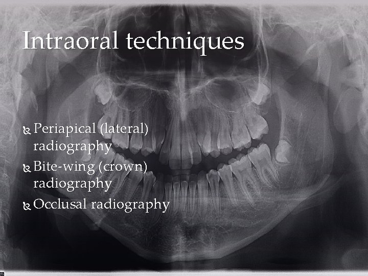 Intraoral techniques Periapical (lateral) radiography Bite-wing (crown) radiography Occlusal radiography 