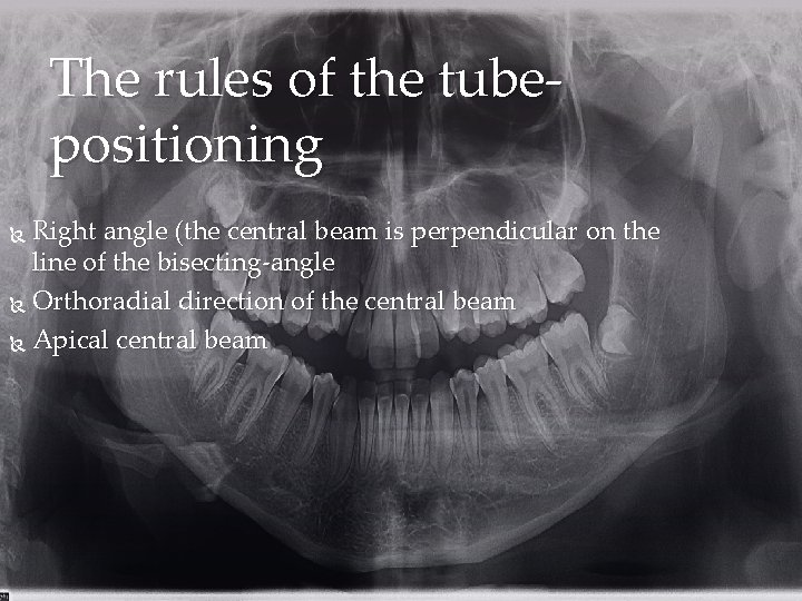 The rules of the tubepositioning Right angle (the central beam is perpendicular on the