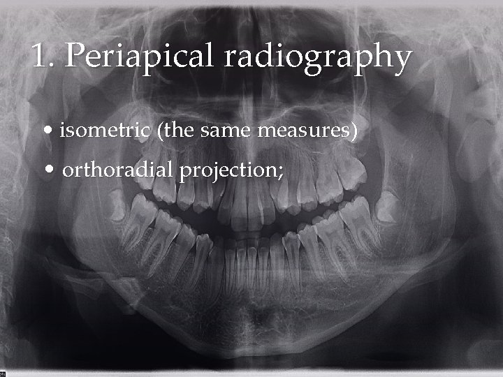 1. Periapical radiography • isometric (the same measures) • orthoradial projection; 