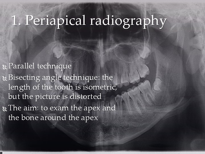 1. Periapical radiography Parallel technique Bisecting angle technique: the length of the tooth is