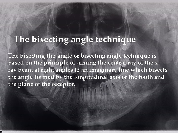 The bisecting angle technique The bisecting-the-angle or bisecting angle technique is based on the