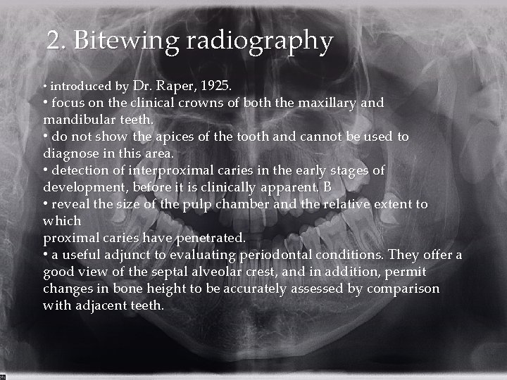 2. Bitewing radiography • introduced by Dr. Raper, 1925. • focus on the clinical