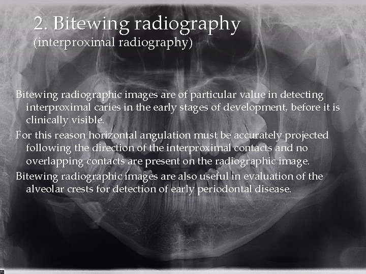 2. Bitewing radiography (interproximal radiography) Bitewing radiographic images are of particular value in detecting