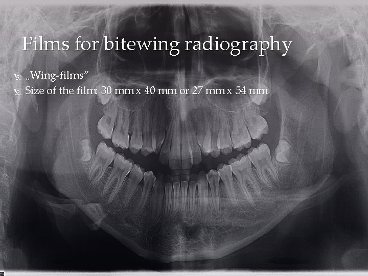 Films for bitewing radiography „Wing-films” Size of the film: 30 mm x 40 mm