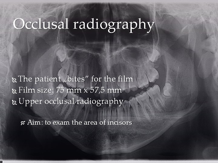 Occlusal radiography The patient „bites” for the film Film size: 75 mm x 57,