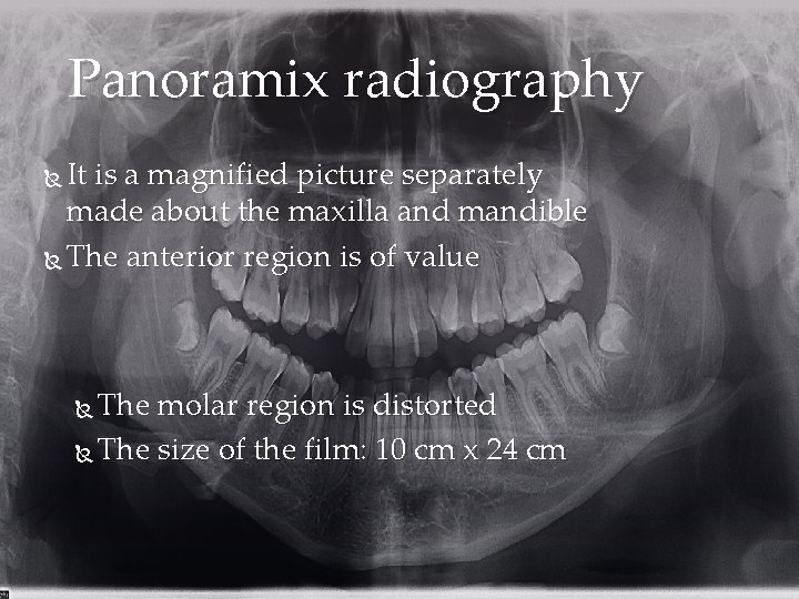 Panoramix radiography It is a magnified picture separately made about the maxilla and mandible