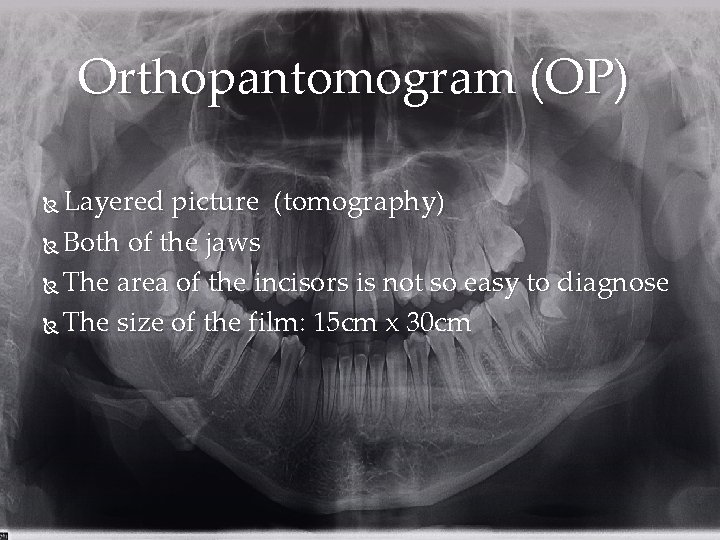 Orthopantomogram (OP) Layered picture (tomography) Both of the jaws The area of the incisors