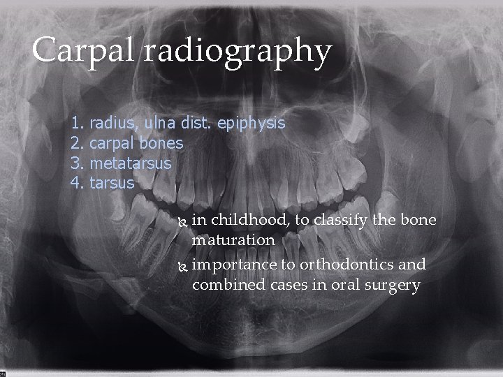 Carpal radiography 1. radius, ulna dist. epiphysis 2. carpal bones 3. metatarsus 4. tarsus