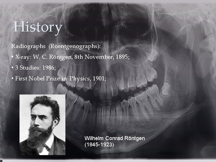 History Radiographs (Roentgenographs): • X-ray: W. C. Röntgen, 8 th November, 1895; • 3