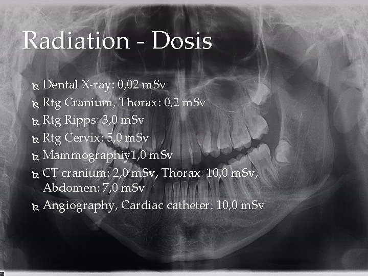 Radiation - Dosis Dental X-ray: 0, 02 m. Sv Rtg Cranium, Thorax: 0, 2
