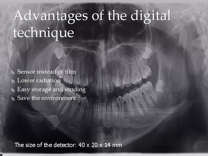 Advantages of the digital technique Sensor instead of film Lower radiation Easy storage and