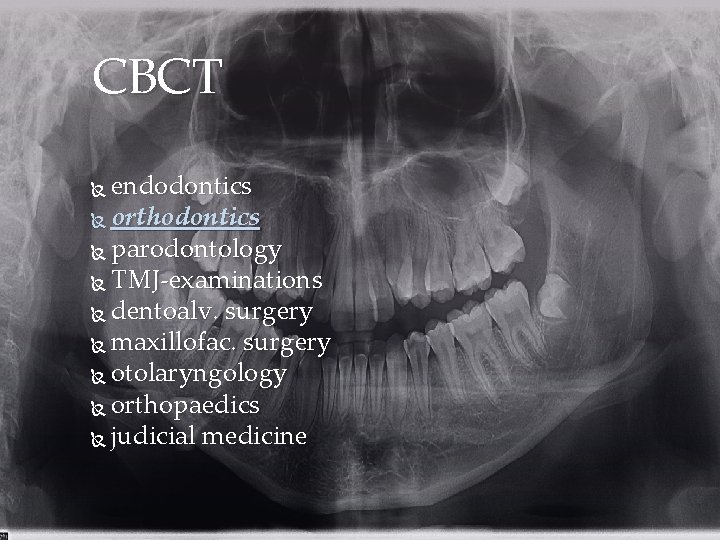 CBCT endodontics orthodontics parodontology TMJ-examinations dentoalv. surgery maxillofac. surgery otolaryngology orthopaedics judicial medicine 