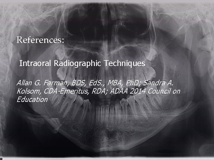 References: Intraoral Radiographic Techniques Allan G. Farman, BDS, Ed. S. , MBA, Ph. D;