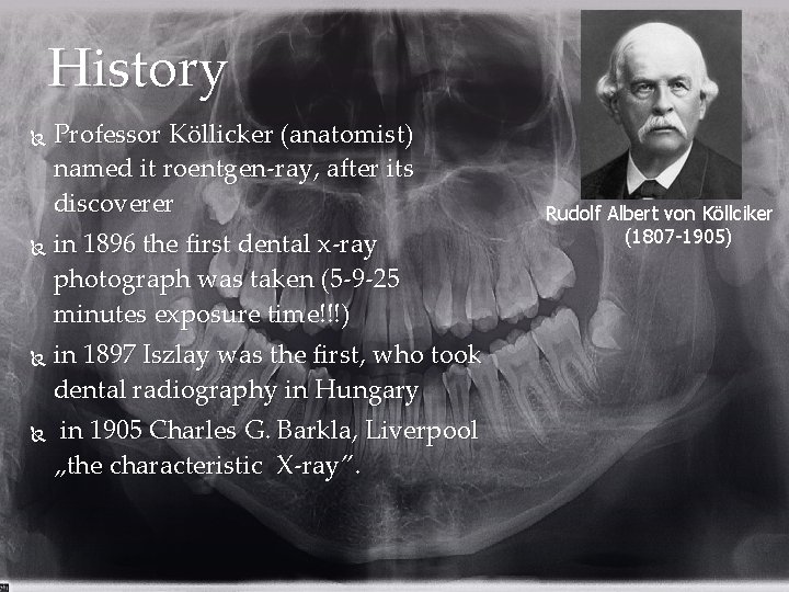 History Professor Köllicker (anatomist) named it roentgen-ray, after its discoverer in 1896 the first
