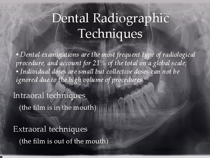 Dental Radiographic Techniques • Dental examinations are the most frequent type of radiological procedure,