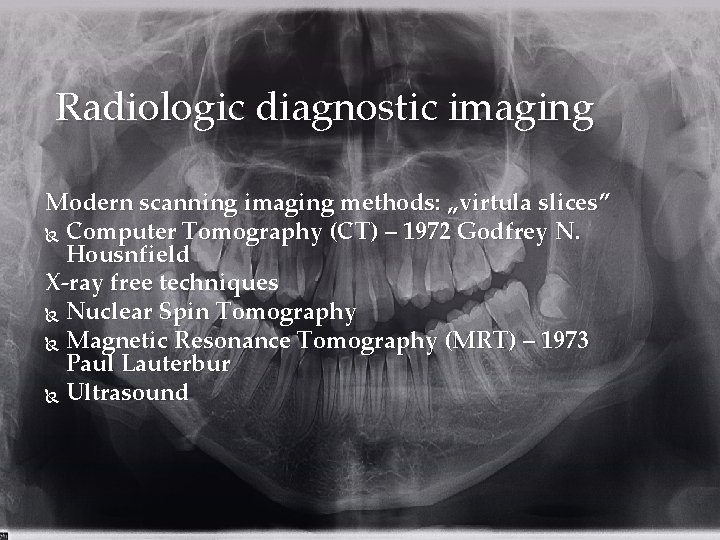 Radiologic diagnostic imaging Modern scanning imaging methods: „virtula slices” Computer Tomography (CT) – 1972
