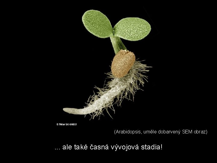 (Arabidopsis, uměle dobarvený SEM obraz) . . . ale také časná vývojová stadia! 