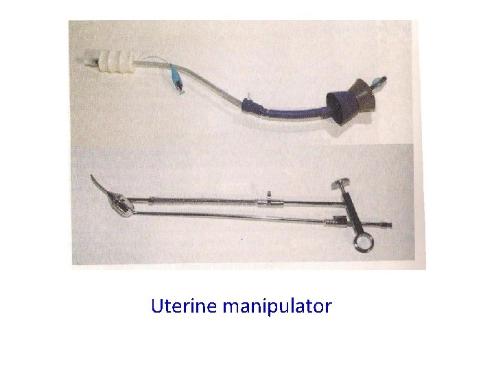Uterine manipulator 