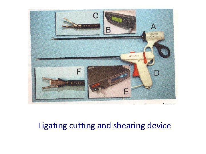 Ligating cutting and shearing device 