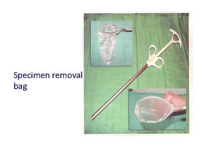 Specimen removal bag 