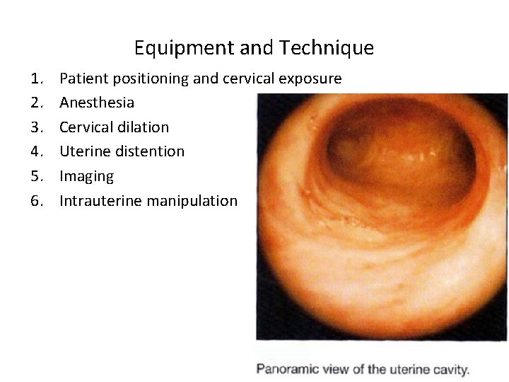 Equipment and Technique 1. 2. 3. 4. 5. 6. Patient positioning and cervical exposure