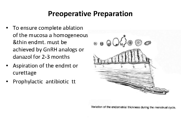 Preoperative Preparation • To ensure complete ablation of the mucosa a homogeneous &thin endmt.