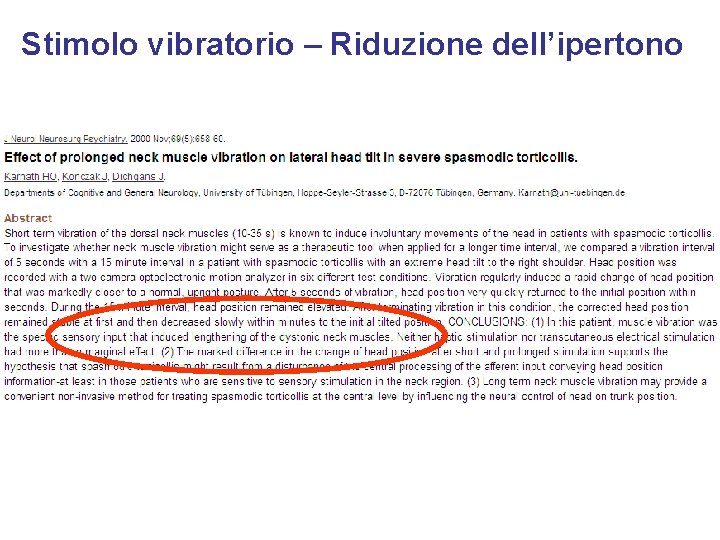 Stimolo vibratorio – Riduzione dell’ipertono 